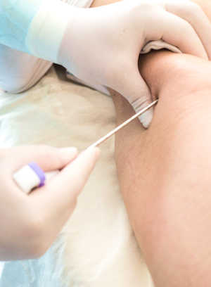 Doação de Medula Óssea